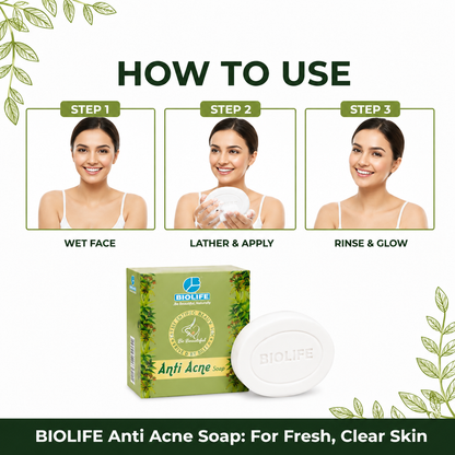 ANTI ACNE SOAP | Fights acne and blemishes 75GM