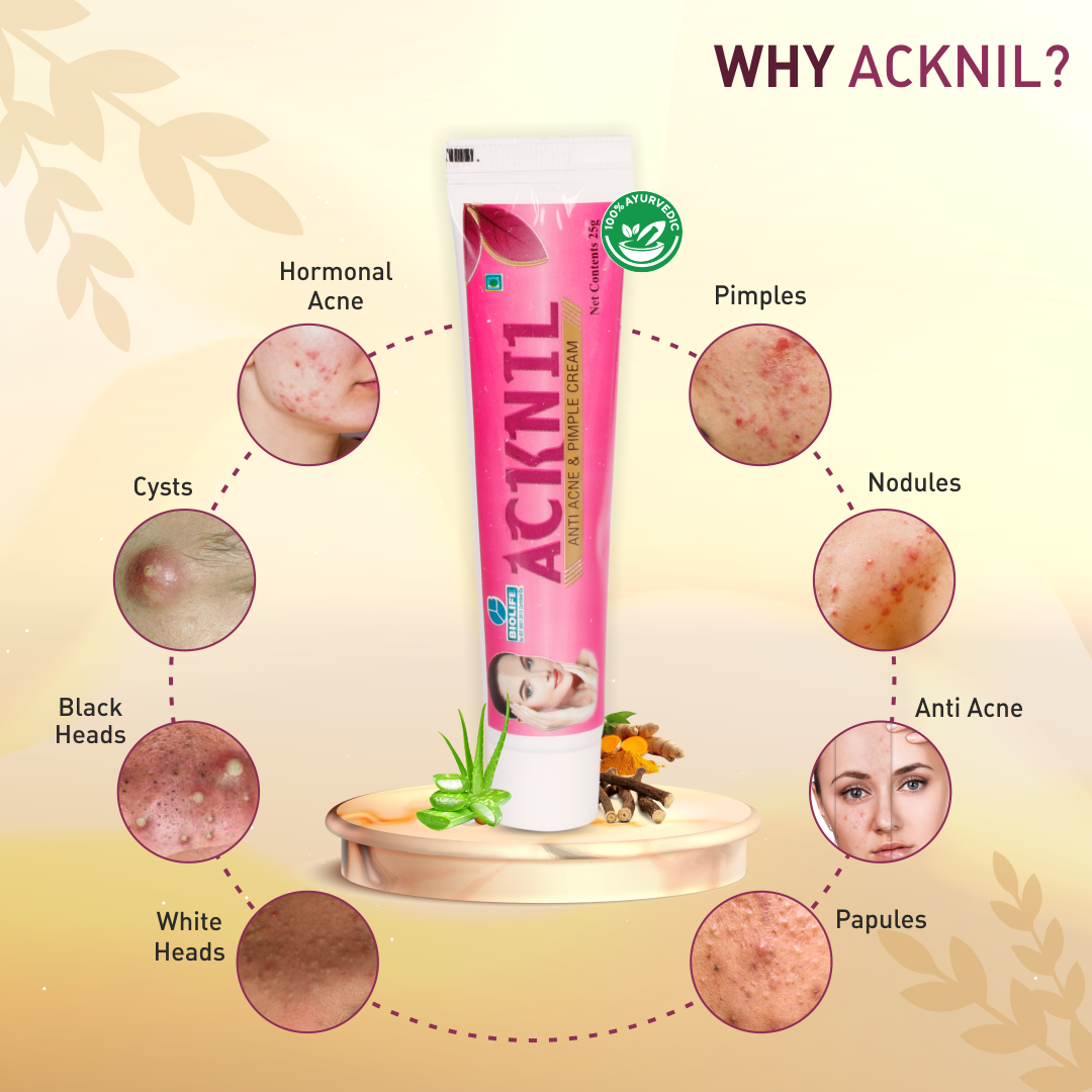 ACKNIL CREAM | Reduce Acne & Pimples 25GM