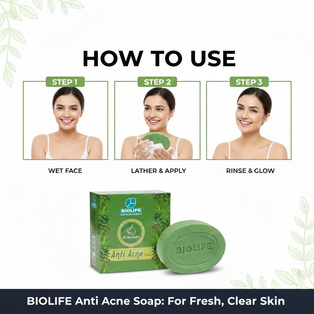 ANTI ACNE SOAP | Fights acne and blemishes 75GM