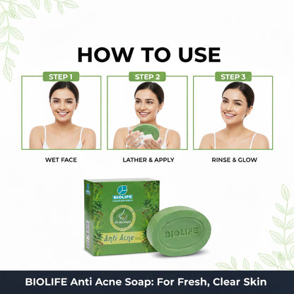 ANTI ACNE SOAP | Fights acne and blemishes 75GM
