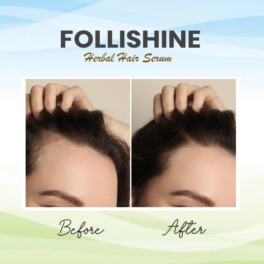 FOLLISHINE HAIR SERUM & SHAMPOO (COMBO PACK)